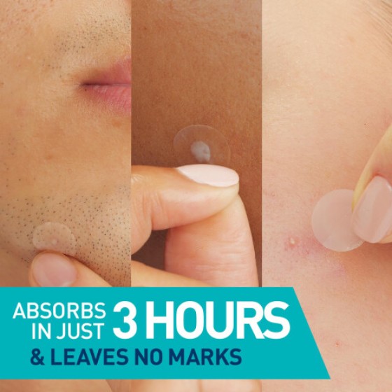 Cerave Plester Hidrokolloid untuk Pengendalian Titik Penyerapan Minyak dengan Ceramides dan Niacinamide, Teruji Alergi dan Cocok untuk Kulit